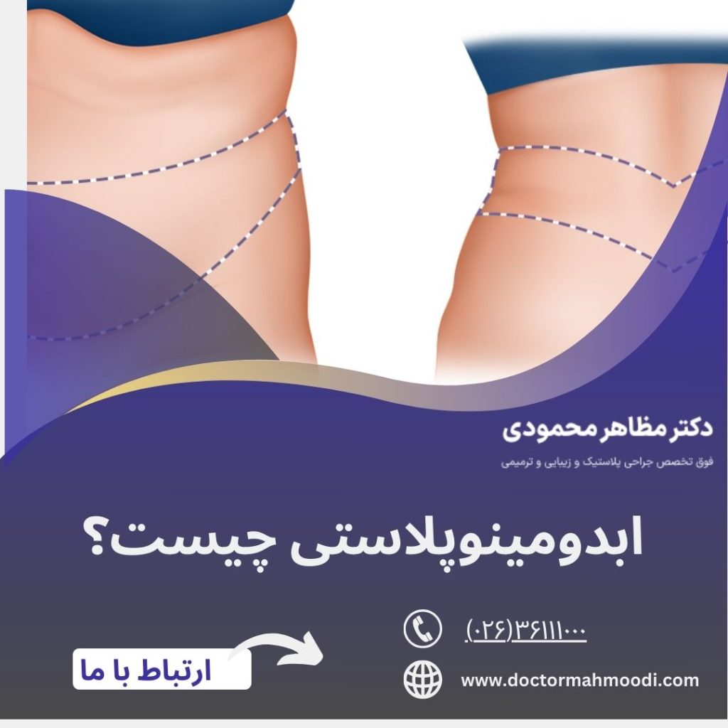جراحی ابدومینوپلاستی