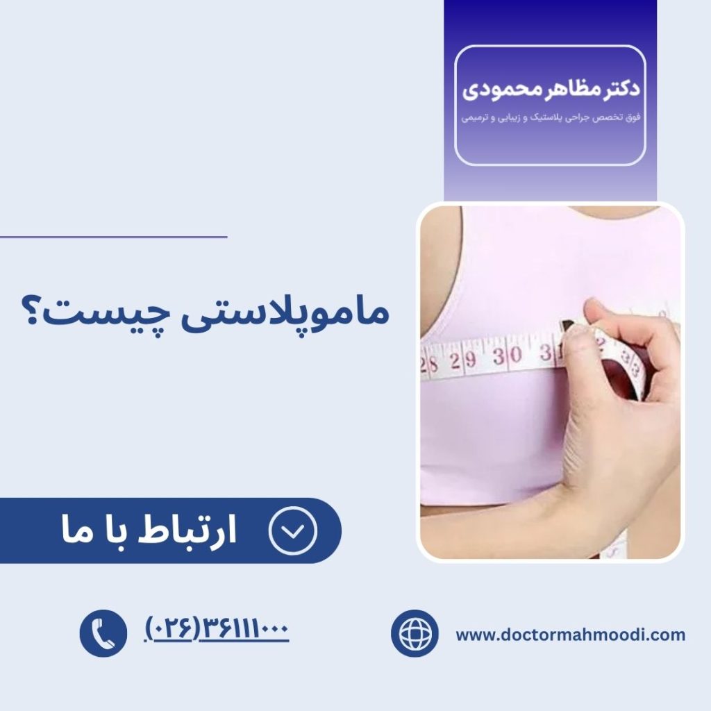 ماموپلاستی