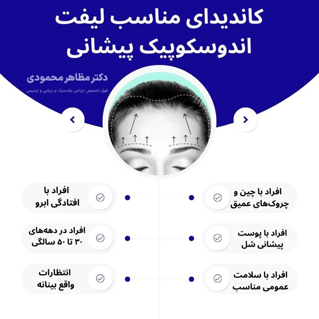 لیفت اندوسکوپیک پیشانی