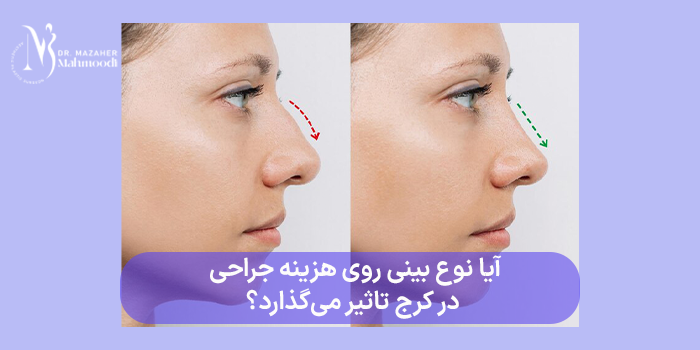 آیا نوع بینی روی هزینه جراحی در کرج تاثیر میگذارد؟