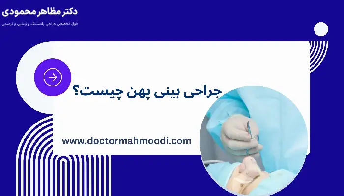 جراحی بینی پهن