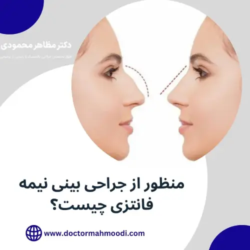 جراحی بینی نیمه فانتزی