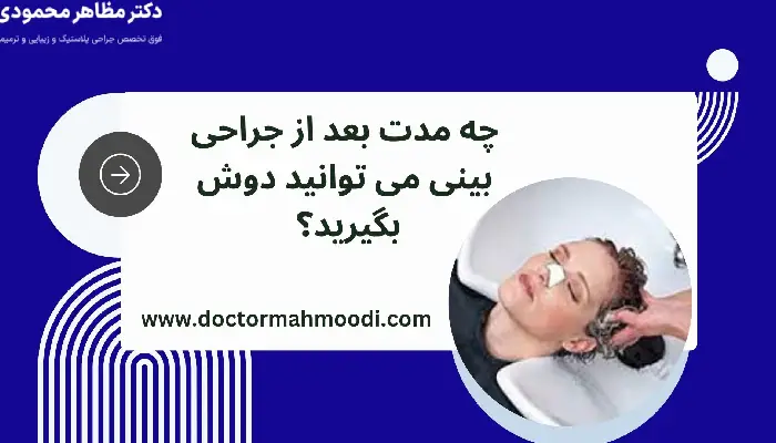 استحمام بعد از عمل بینی