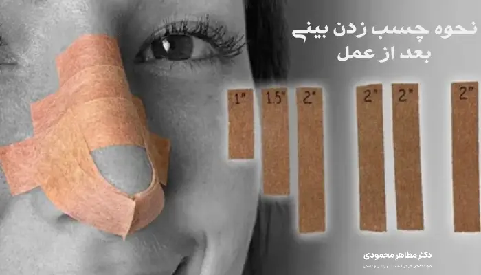 چسب زدن بینی بعد از عمل