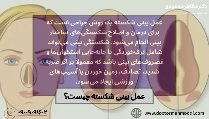عمل بینی شکسته