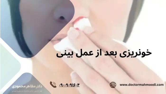 خونریزی بعد از عمل بینی