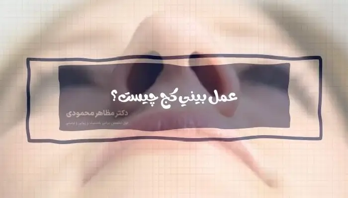 عمل بینی کج