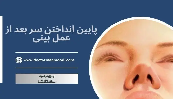 پایین انداختن سر بعد از عمل بینی