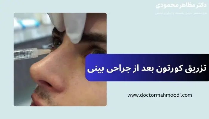 تزریق کورتون بعد از جراحی بینی