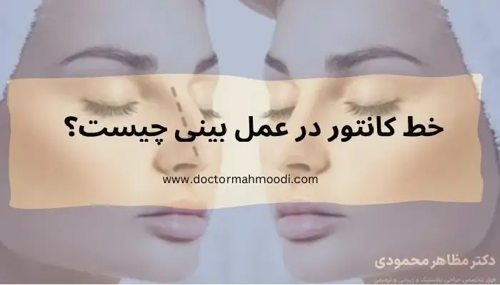 خط کانتور در عمل بینی