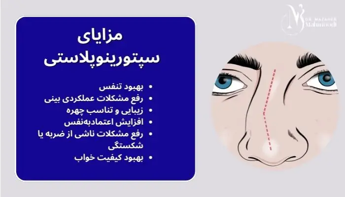 مزایای سپتورینوپلاستی