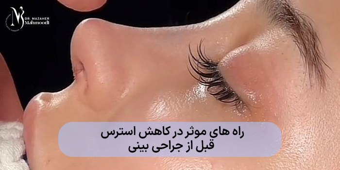 راه های موثر در کاهش استرس قبل از جراحی بینی