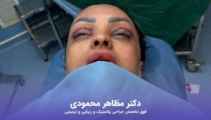 مقایسه مزایای عمل پلک و لیفت شقیقه