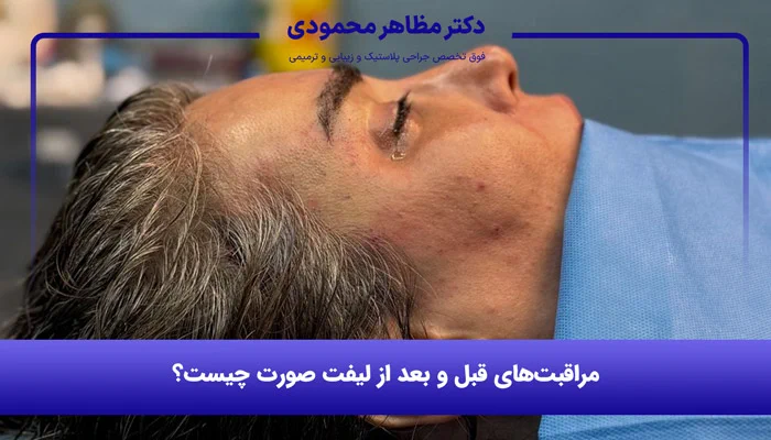 مراقبتهای بعد از جراحی لیفت صورت