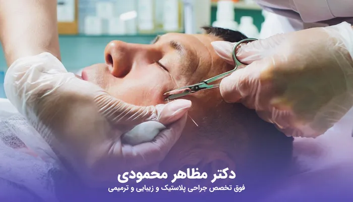 لیفت صورت برای مردان به همراه مزایا و هزینه