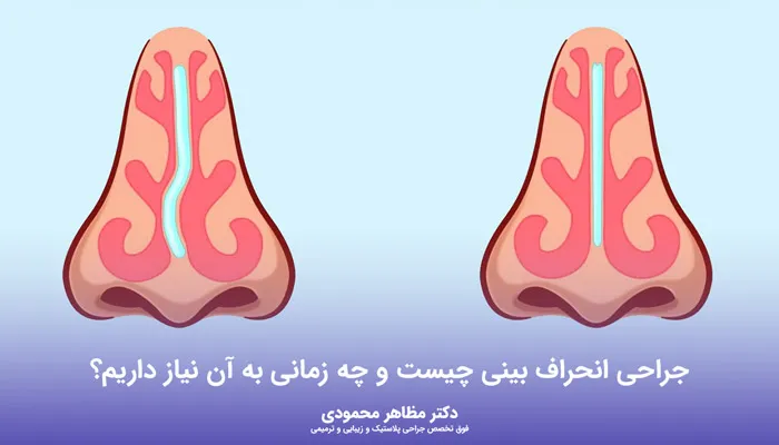 جراحی انحراف بینی