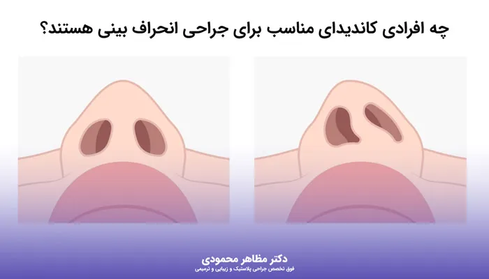 چه کسانی به جراحی انحراف بینی نیاز دارند؟