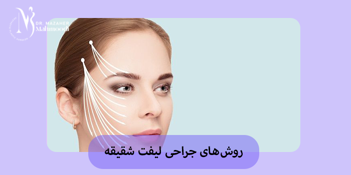 روشهای جراحی لیفت شقیقه