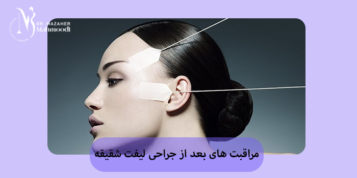 مراقبت های بعد از جراحی لیفت شقیقه